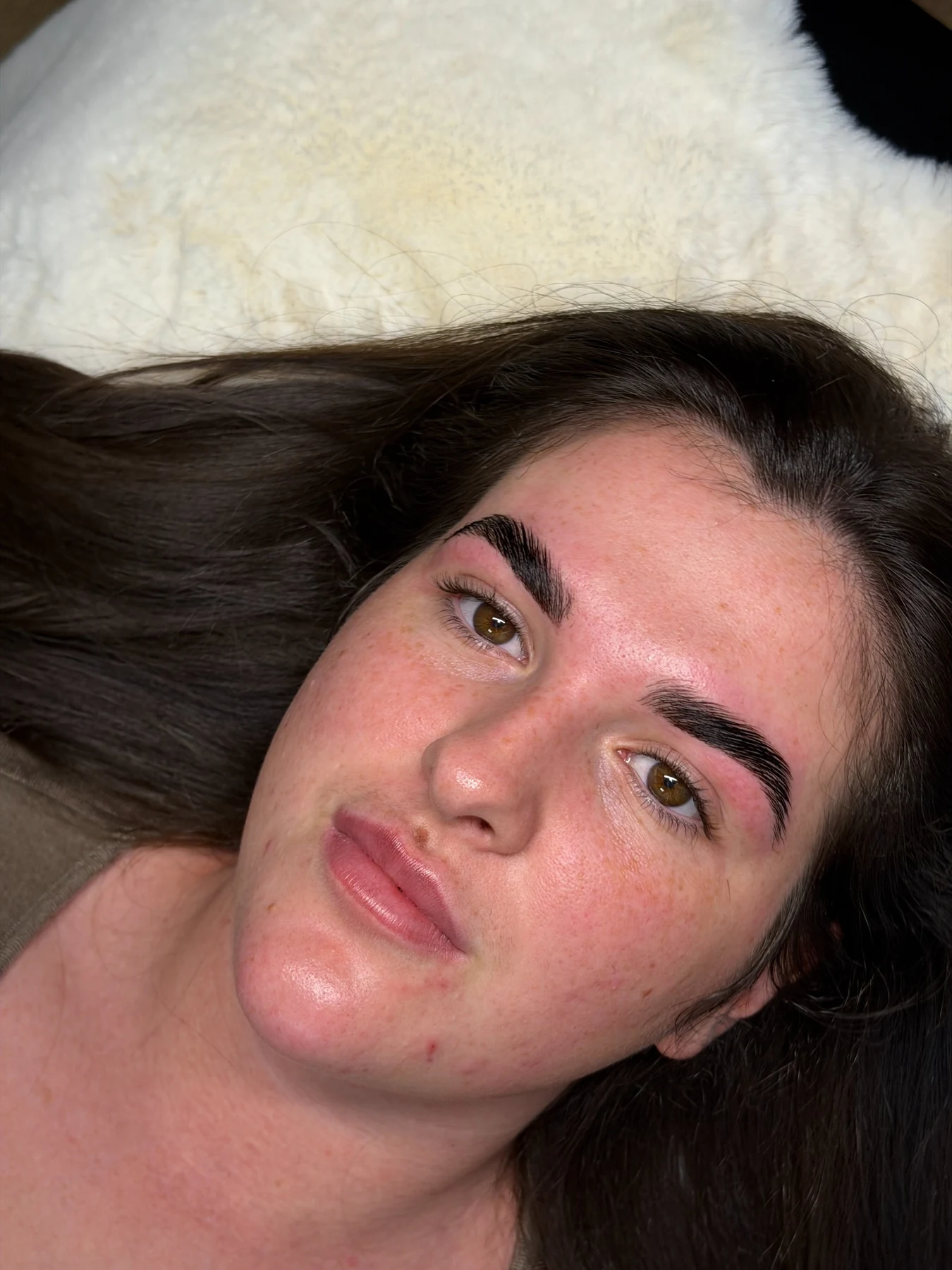 Brow result